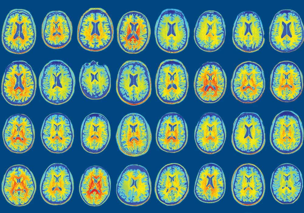 A colorful scan of brains.