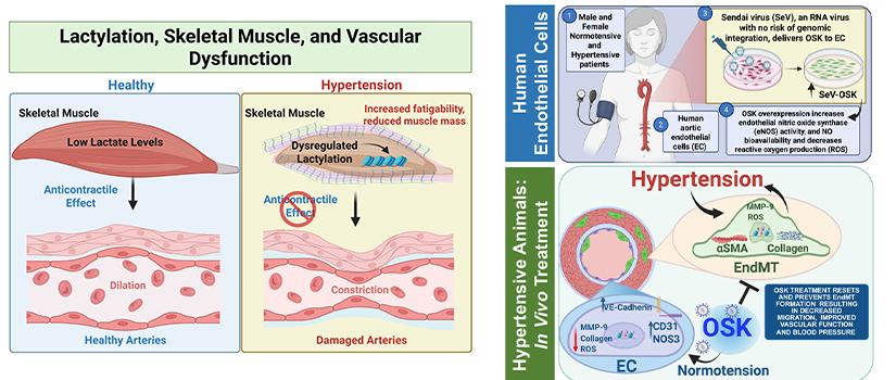 Graphic abstracts of hypertension study by SOMC faculty